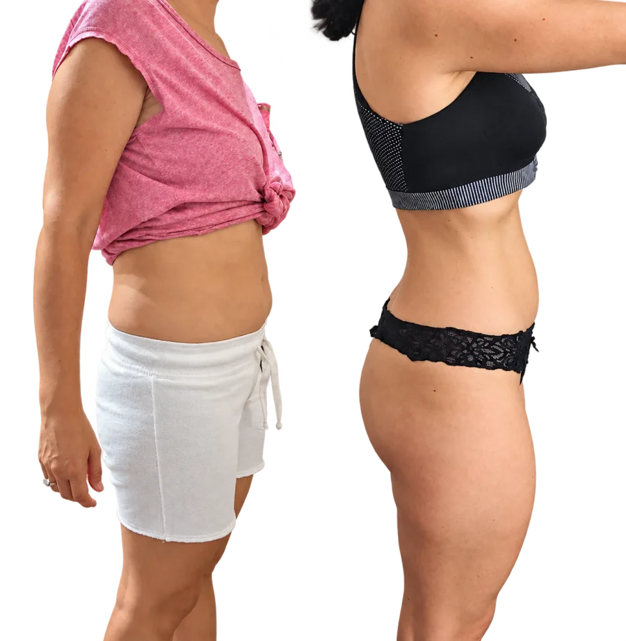 Antes y después de Graciela, 46 años
