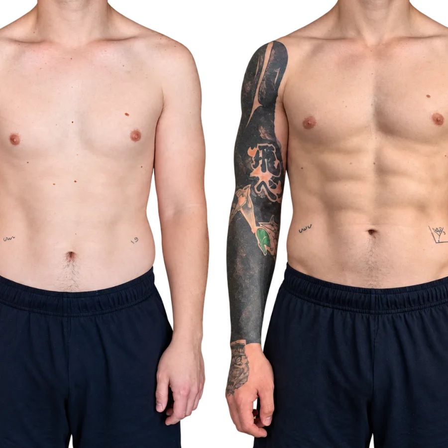 Antes y después de Joaquín, 29 años